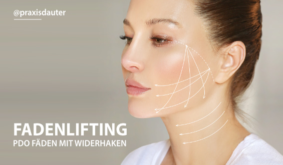 Fadenlifting PDO Fäden Düsseldorf